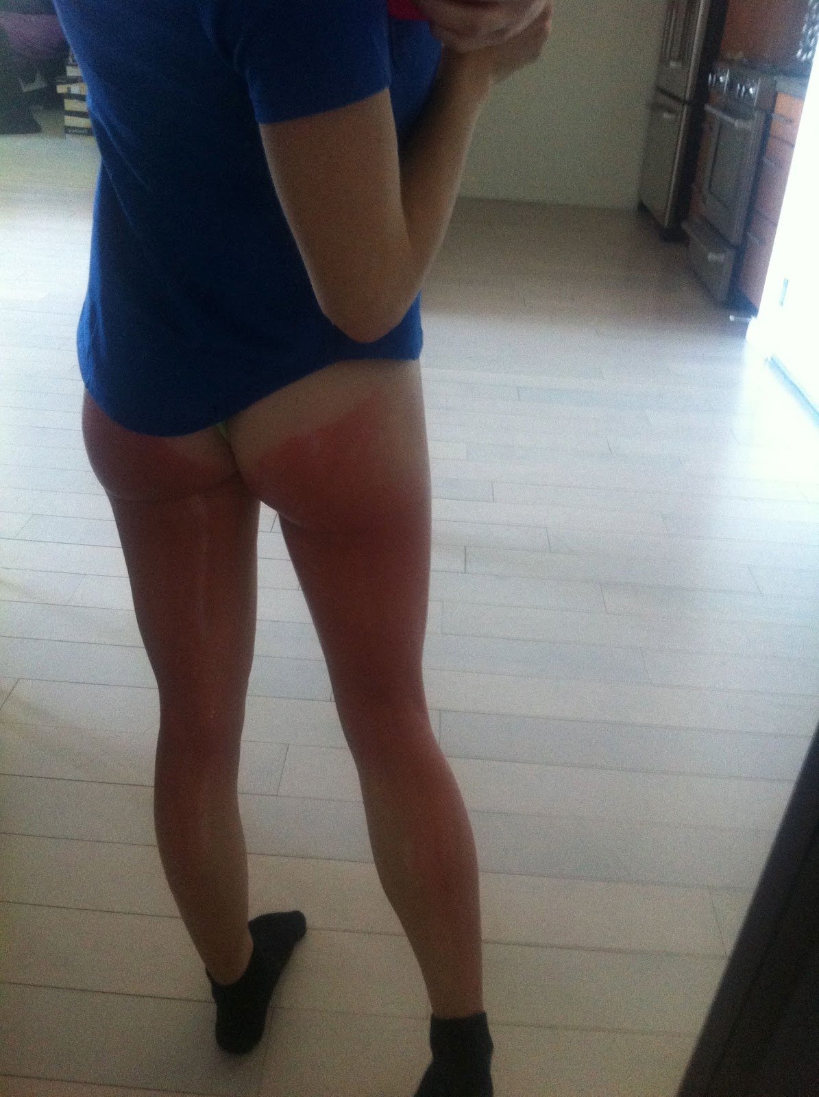 Jillian Murray taking a picture of her sun burn exposing butt